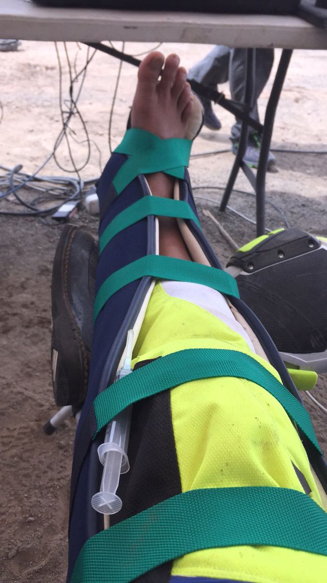 Photo of Aravind KP’s ankle injury halts his Dakar 2018